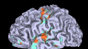 Scoperto un circuito del cervello che libera la creativit&agrave;