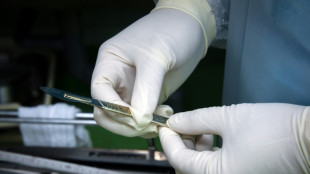 Un angoleño fue operado por un médico a 11.000 km de distancia, una primicia en África