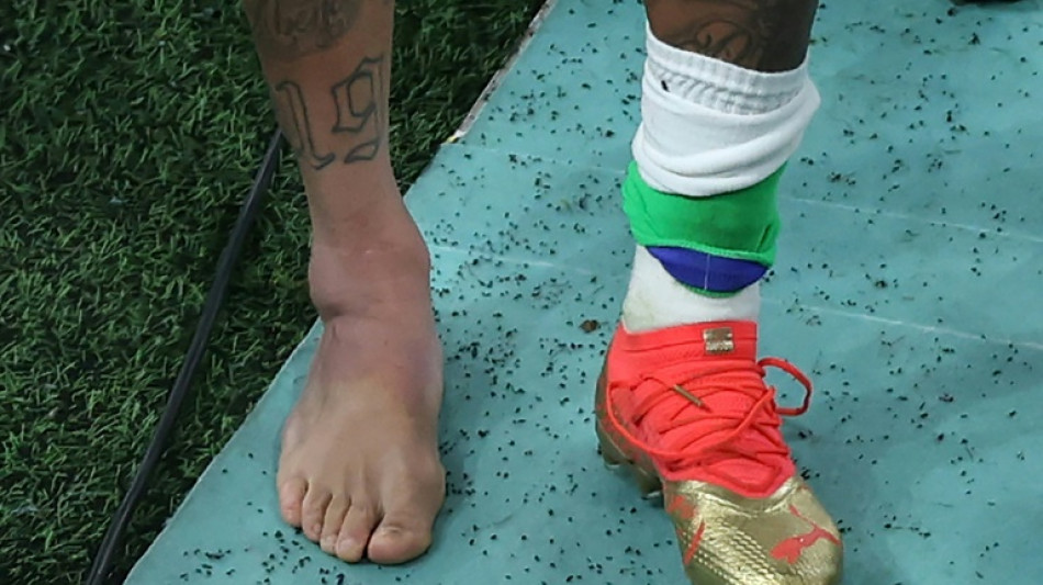 Neymar to miss Brazil's next World Cup match with ankle injury