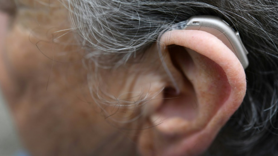 BGH verhandelt &uuml;ber Werbung mit Payback-Punkten beim Kauf von H&ouml;rger&auml;ten