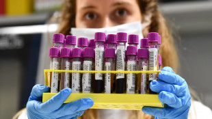 Nel sangue le spie del Parkinson gi&agrave; 7 anni prima dei sintomi