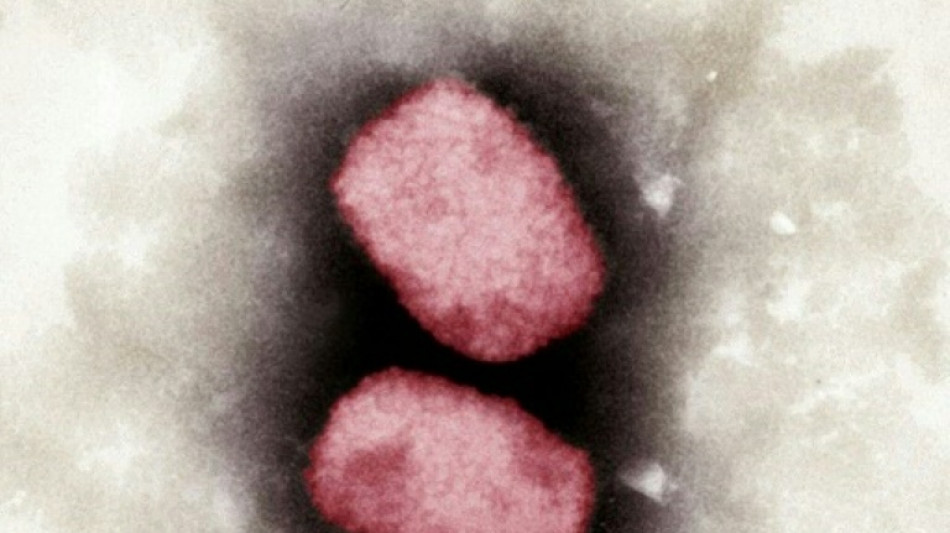 Stiko empfiehlt Impfung gegen Affenpocken f&uuml;r Risikopersonen