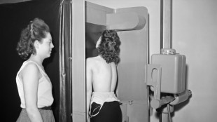 Los estereotipos de g&eacute;nero son malos para la salud