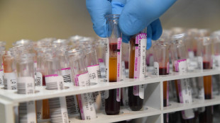 Verso test portatili,rapidi e precisi per le pandemie del futuro