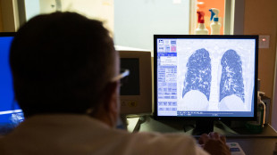 Broncopneumopatia, una triplice terapia migliora qualità di vita