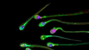 Pi&ugrave; longevi gli uomini che hanno una migliore qualit&agrave; del seme