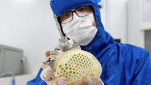 Coeur artificiel: Carmat obtient un nouveau d&eacute;lai pour tenter de trouver un repreneur